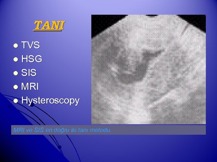 TANI TVS l HSG l SIS l MRI l Hysteroscopy l MRI ve SIS