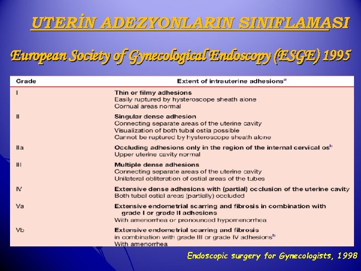 UTERİN ADEZYONLARIN SINIFLAMASI European Society of Gynecological Endoscopy (ESGE) 1995 Endoscopic surgery for Gynecologists,