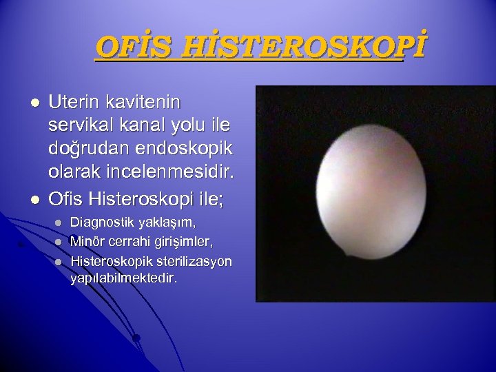 OFİS HİSTEROSKOPİ l l Uterin kavitenin servikal kanal yolu ile doğrudan endoskopik olarak incelenmesidir.