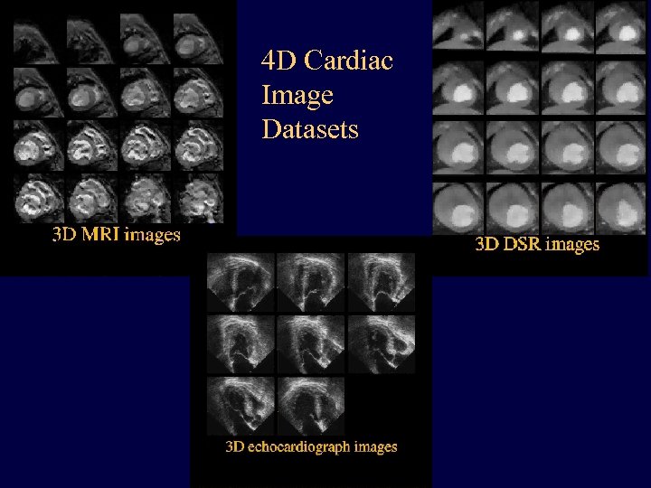 4 D Cardiac Image Datasets 