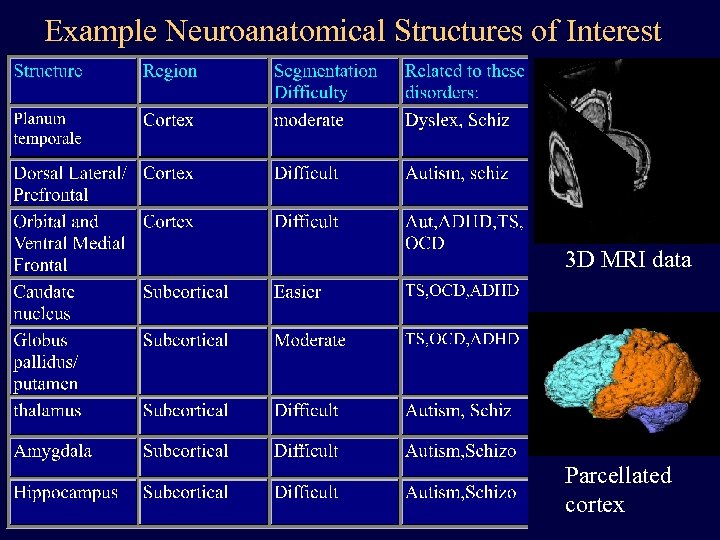 Example Neuroanatomical Structures of Interest 3 D MRI data Parcellated cortex 