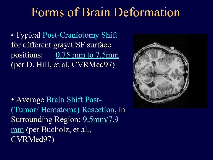 Forms of Brain Deformation • Typical Post-Craniotomy Shift for different gray/CSF surface positions: 0.