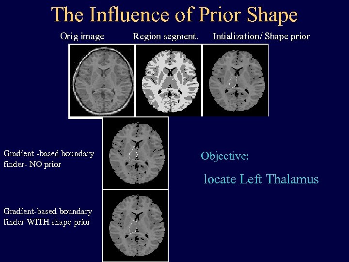 The Influence of Prior Shape Orig image Region segment. Intialization/ Shape prior Integrated (region-segment.