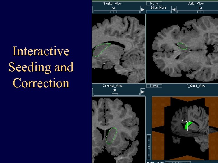 Interactive Seeding and Correction 