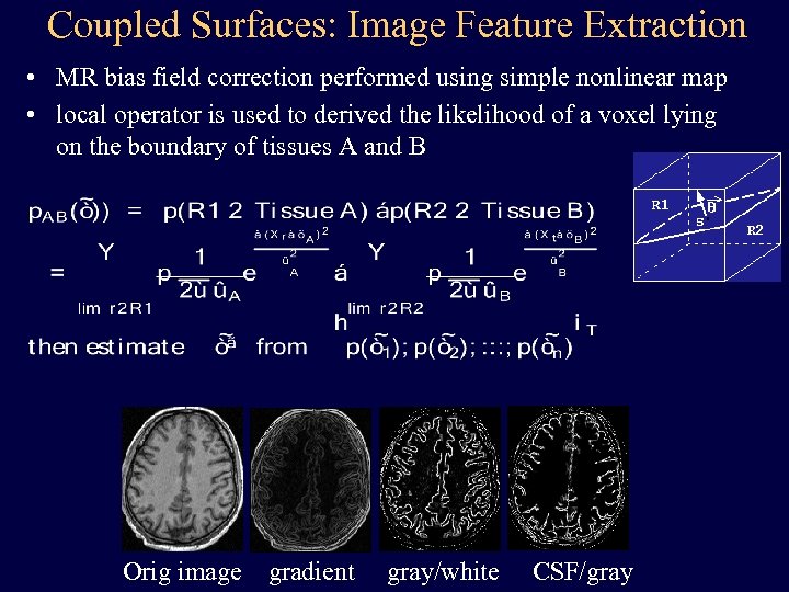 Coupled Surfaces: Image Feature Extraction • MR bias field correction performed using simple nonlinear