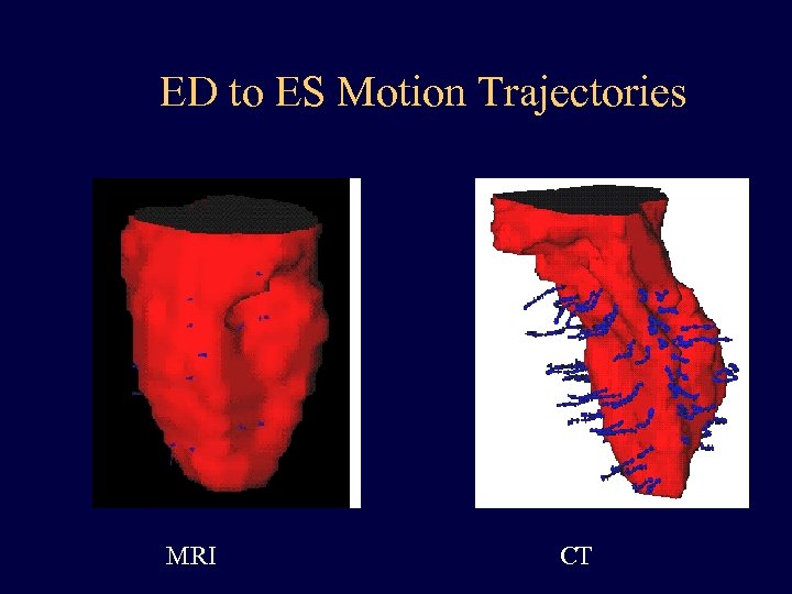 ED to ES Motion Trajectories MRI CT 