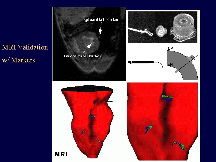 MRI Validation w/ Markers 