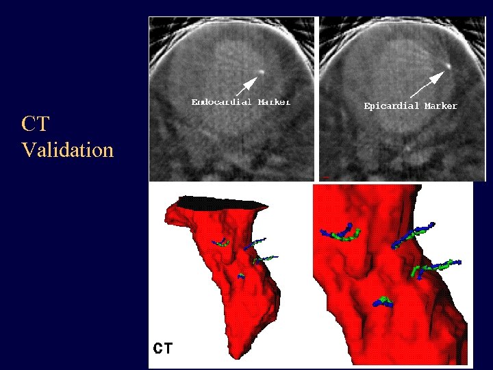 CT Validation 