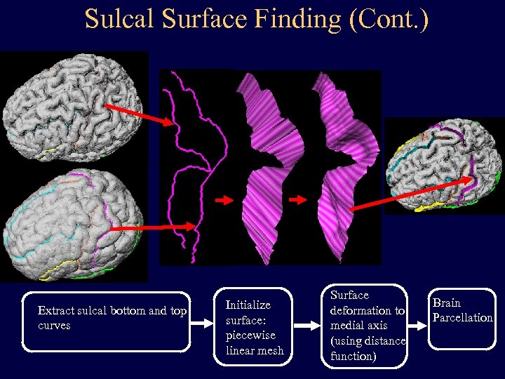 Sulcal Surface Finding (Cont. ) Extract sulcal bottom and top curves Initialize surface: piecewise