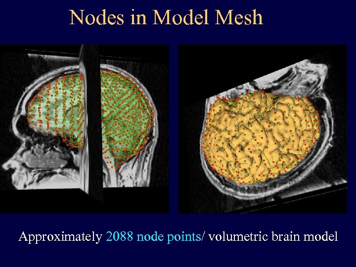 Nodes in Model Mesh Approximately 2088 node points/ volumetric brain model 