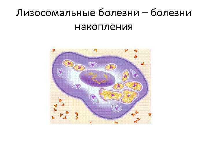 Лизосомальные болезни – болезни накопления 