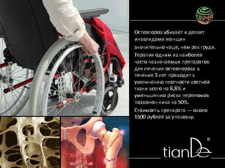 Остеопороз убивает и делает инвалидами женщин значительно чаще, чем рак груди. Терапия одним из