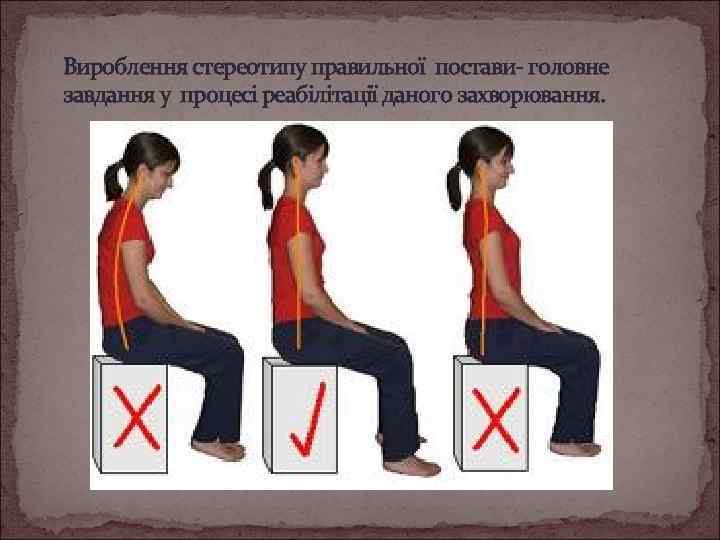 Вироблення стереотипу правильної постави- головне завдання у процесі реабілітації даного захворювання. 