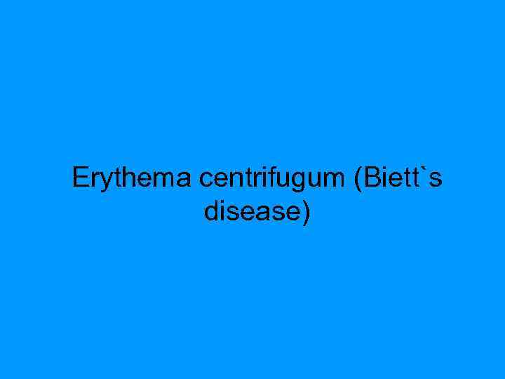 Erythema centrifugum (Biett`s disease) 