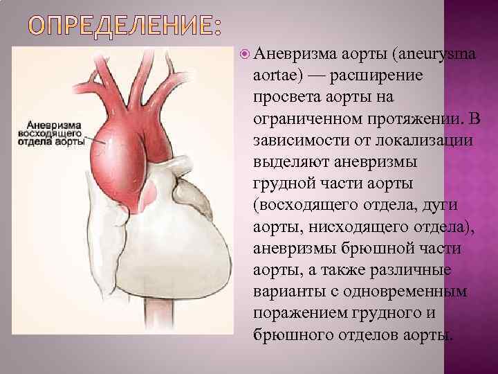 Аневризма отдела аорты. Мешковидная аневризма дуги аорты. Расширение просвета аорты. Аневризм восходящей аорты. Аневризматическое расширение восходящего отдела аорты.