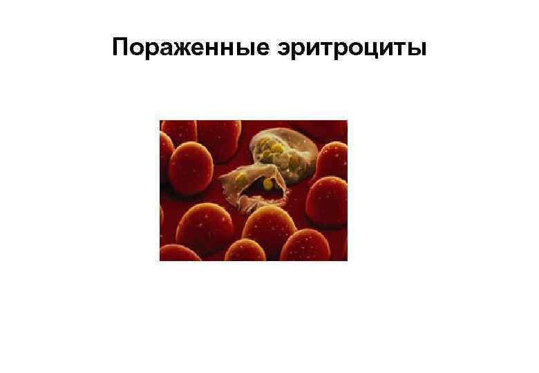 Пораженные эритроциты 