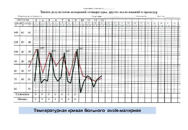 Температурная кривая больного ovale-малярией 