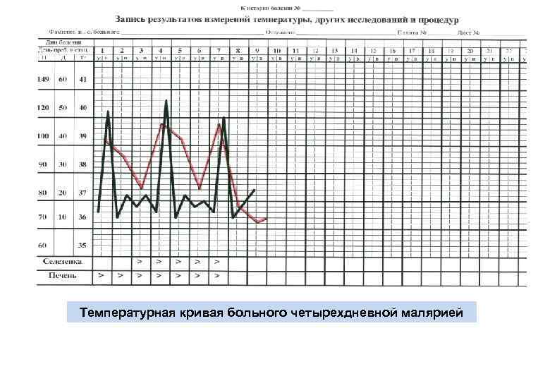 Графические изображения в температурном листе пациента выполняет