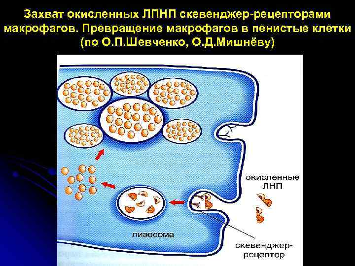 Захват окисленных ЛПНП скевенджер-рецепторами макрофагов. Превращение макрофагов в пенистые клетки (по О. П. Шевченко,