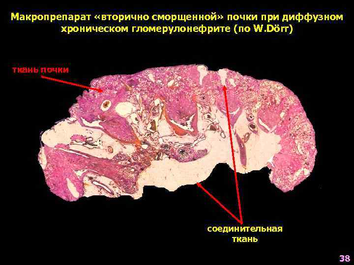 Гломерулонефрит у кошек