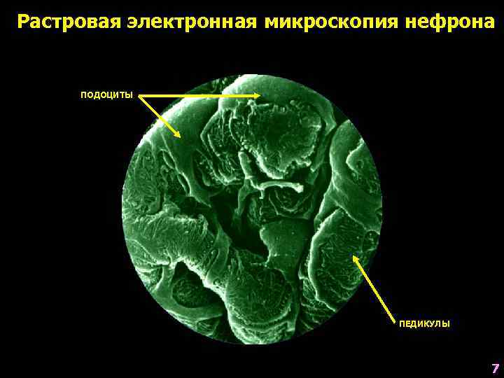 Растровая электронная микроскопия нефрона ПОДОЦИТЫ ПЕДИКУЛЫ 7 