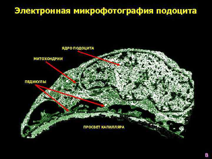 Электронная микрофотография подоцита ЯДРО ПОДОЦИТА МИТОХОНДРИИ ПЕДИКУЛЫ ПРОСВЕТ КАПИЛЛЯРА 8 