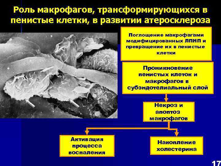 Роль макрофагов, трансформирующихся в пенистые клетки, в развитии атеросклероза Поглощение макрофагами модифицированных ЛПНП и