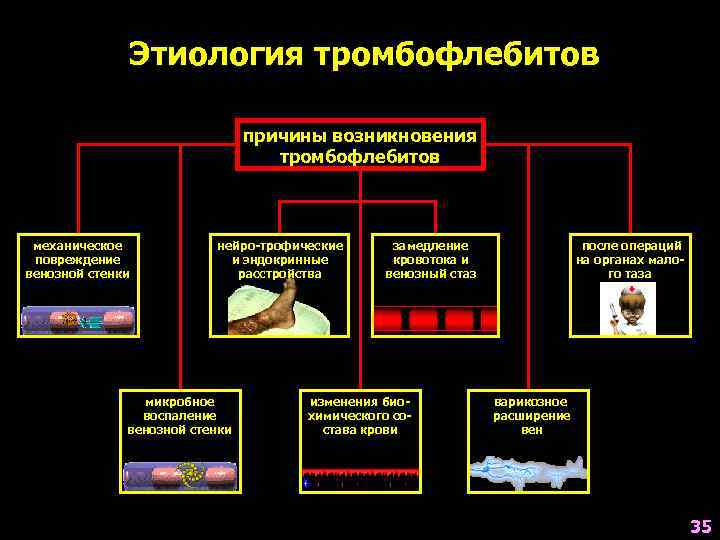 Этиология тромбофлебитов причины возникновения тромбофлебитов механическое повреждение венозной стенки нейро-трофические и эндокринные расстройства микробное