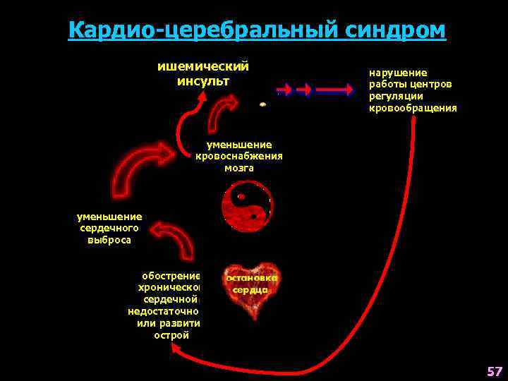 Кардио-церебральный синдром ишемический инсульт нарушение работы центров регуляции кровообращения уменьшение кровоснабжения мозга уменьшение сердечного