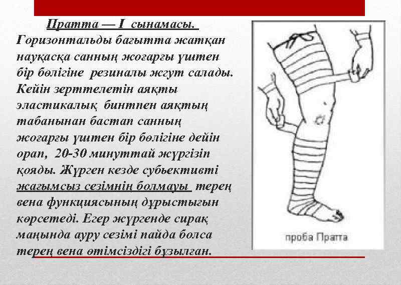 Пратта — Ι сынамасы. Горизонтальды бағытта жатқан науқасқа санның жоғарғы үштен бір бөлігіне резиналы