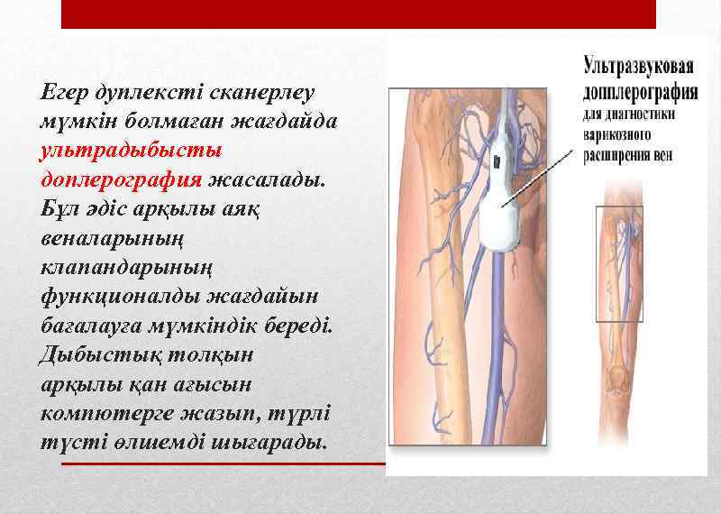 Егер дуплексті сканерлеу мүмкін болмаған жағдайда ультрадыбысты доплерография жасалады. Бұл әдіс арқылы аяқ веналарының