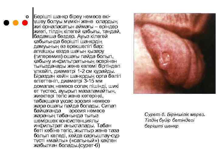 ¢ Берішті шанкр біреу немесе екіүшеу болуы мүмкін және олардың жиі орналасатын аймағы –