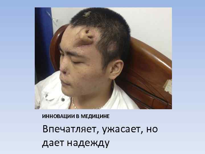 ИННОВАЦИИ В МЕДИЦИНЕ Впечатляет, ужасает, но дает надежду 