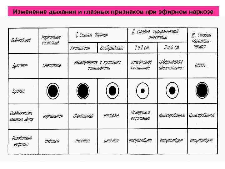 Изменение дыхания и глазных признаков при эфирном наркозе 