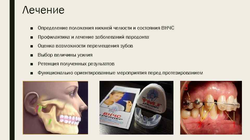 Лечение ■ Определение положения нижней челюсти и состояния ВНЧС ■ Профилактика и лечение заболеваний