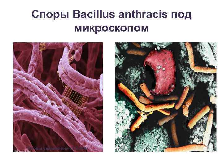 Споры Вacillus anthracis под микроскопом Споры увеличение x 18, 300 