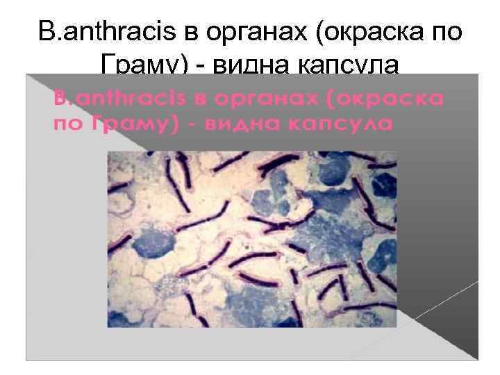 B. аnthracis в органах (окраска по Граму) - видна капсула 