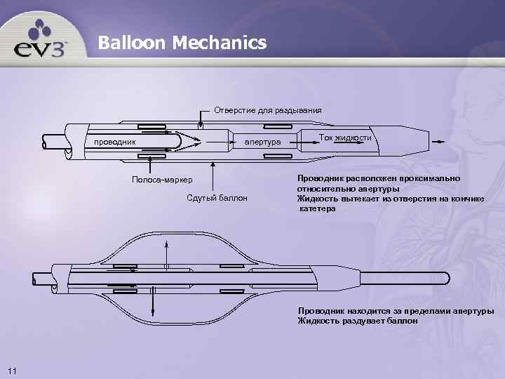 Balloon Mechanics Отверстие для раздывания апертура проводник Полоса-маркер Сдутый баллон Ток жидкости Проводник расположен