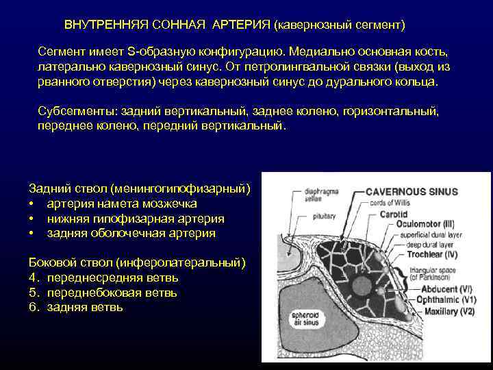 ВНУТРЕННЯЯ СОННАЯ АРТЕРИЯ (кавернозный сегмент) Сегмент имеет S-образную конфигурацию. Медиально основная кость, латерально кавернозный