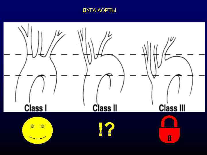 ДУГА АОРТЫ !? 