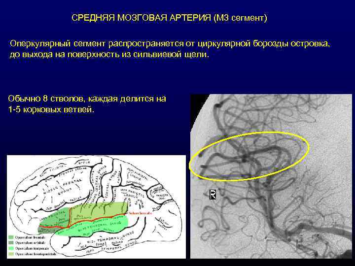 СРЕДНЯЯ МОЗГОВАЯ АРТЕРИЯ (М 3 сегмент) Оперкулярный сегмент распространяется от циркулярной борозды островка, до