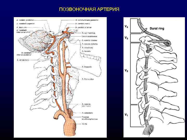 ПОЗВОНОЧНАЯ АРТЕРИЯ 