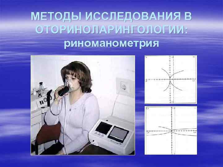 МЕТОДЫ ИССЛЕДОВАНИЯ В ОТОРИНОЛАРИНГОЛОГИИ: риноманометрия 