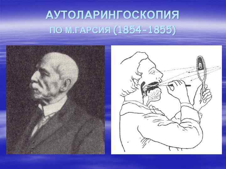 АУТОЛАРИНГОСКОПИЯ ПО М. ГАРСИЯ (1854 -1855) 