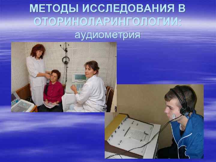 МЕТОДЫ ИССЛЕДОВАНИЯ В ОТОРИНОЛАРИНГОЛОГИИ: аудиометрия 
