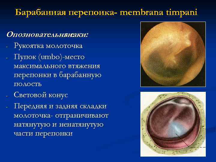 Барабанная перепонка- membrana timpani Опозновательные знаки: - - Рукоятка молоточка Пупок (umbo)-место максимального втяжения