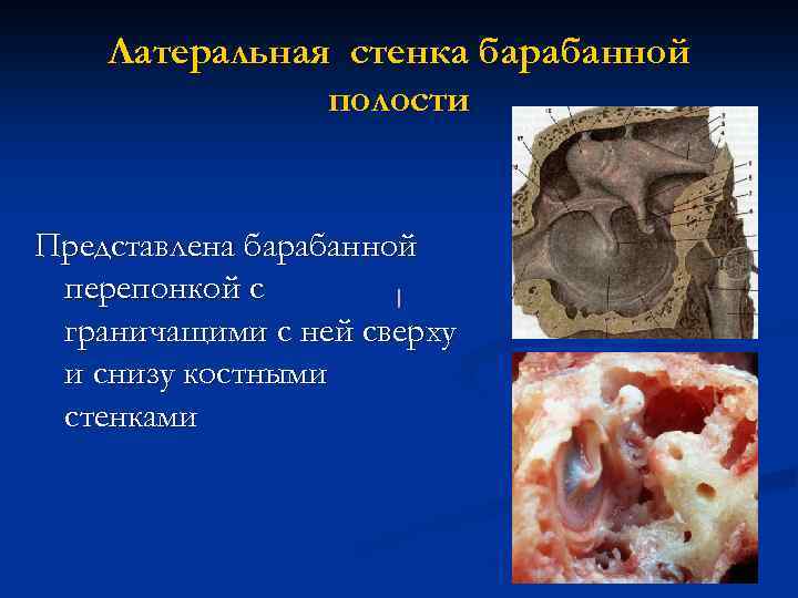 Латеральная стенка барабанной полости Представлена барабанной перепонкой с граничащими с ней сверху и снизу