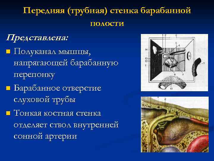 Передняя (трубная) стенка барабанной полости Представлена: Полуканал мышцы, напрягающей барабанную перепонку n Барабанное отверстие