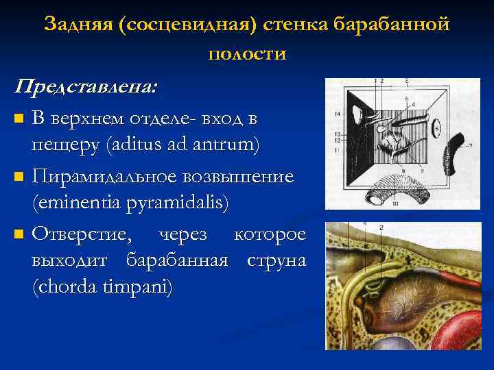 Задняя (сосцевидная) стенка барабанной полости Представлена: В верхнем отделе- вход в пещеру (aditus ad