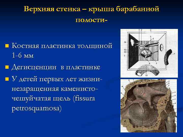 Верхняя стенка – крыша барабанной полости. Костная пластинка толщиной 1 -6 мм n Дегисценции